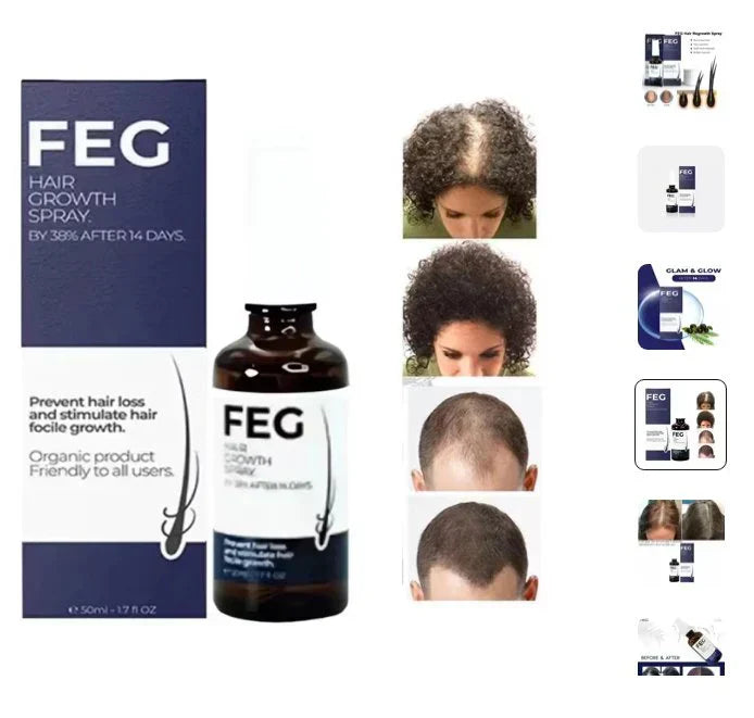 Hair Growth Spray | بخاخ نمو الشعر